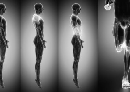 Placements – oder warum das Pferd den Körper des Reiters braucht